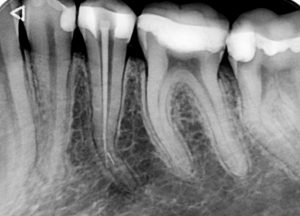 1-300x216-6722b6b958f83